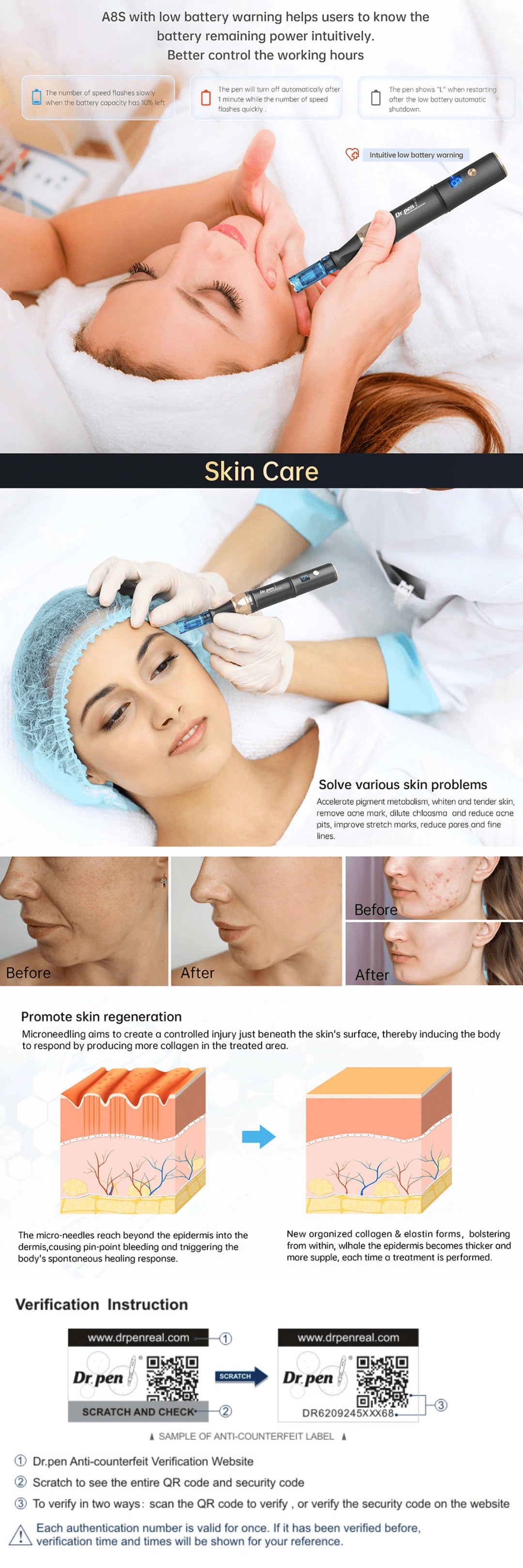 Dr.Pen A8S Wireless Microneedling Pen | USB-C Rechargeable - Feature Image 2