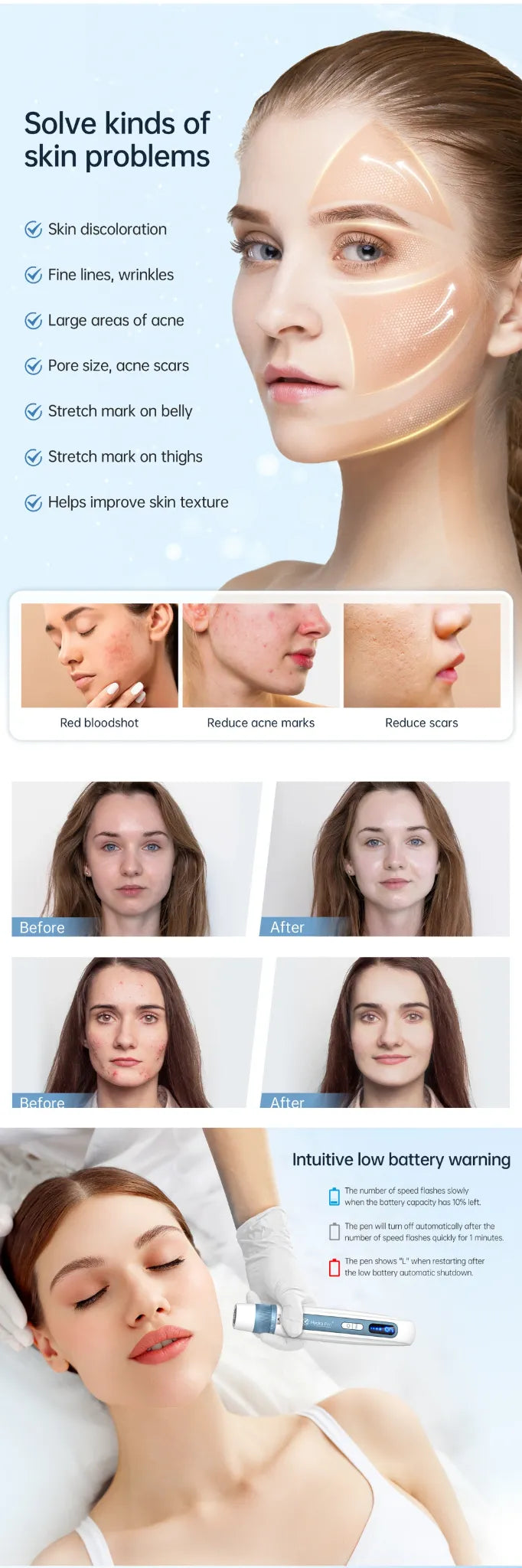Dr.Pen Hydra Pen H5 | 2-in-1 Serum Microneedling Pen White - Feature Image 3