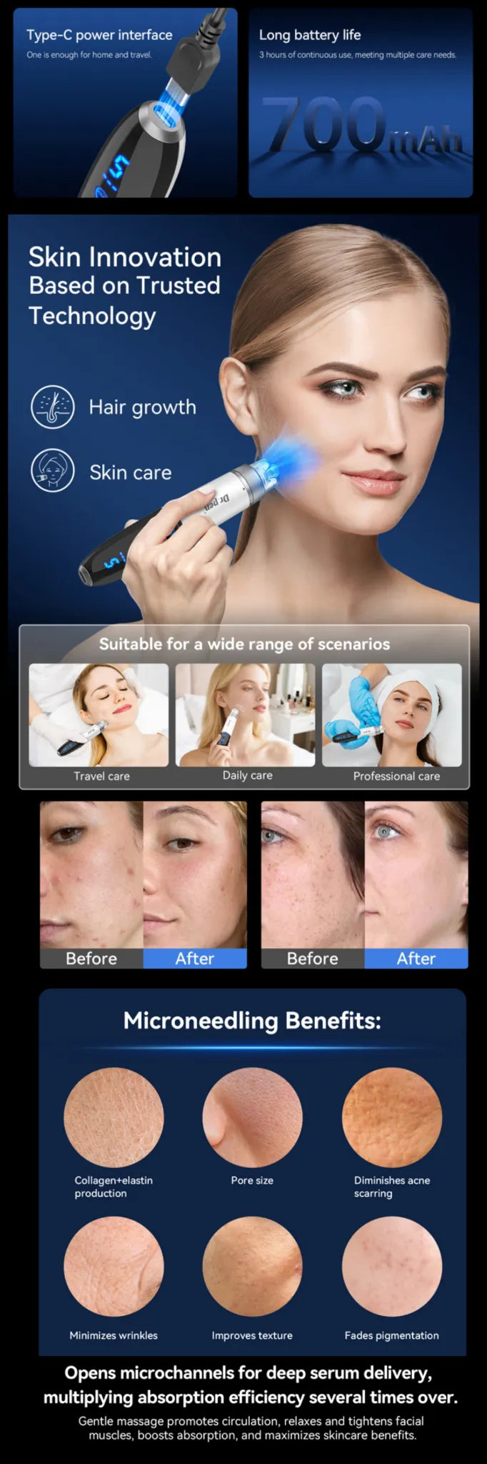 Dr.Pen Q1S Compact Microneedling Pen - Feature Image 1